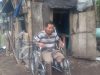 Kisah Sedih Suriyono Bertahan di Gubuk Tua dengan Satu Kaki