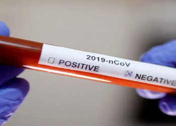 Hasil Swab Pasien PDP Asal Mopuya Negatif