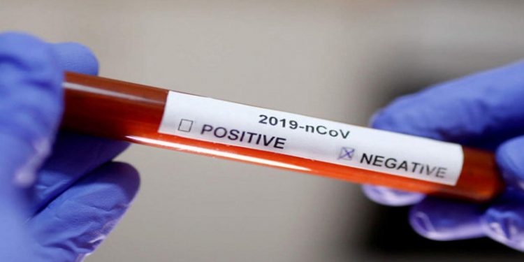 Hasil Swab Pasien PDP Asal Mopuya Negatif