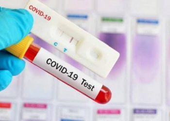 Bocah Perempuan Asal Kecamatan Lolak Reaktif Rapid Test