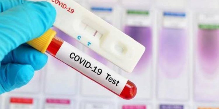 Bocah Perempuan Asal Kecamatan Lolak Reaktif Rapid Test