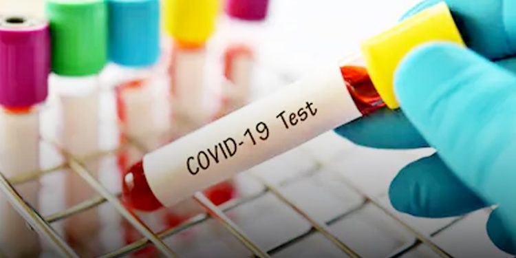 Dinkes Kotamobagu Tunggu Hasil 100 Swab