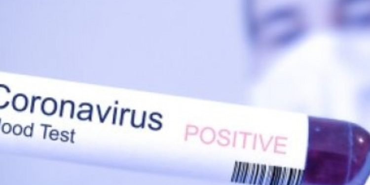 Satu Warga Bolsel Positif Corona, Bupati Minta Warga Tidak Panik