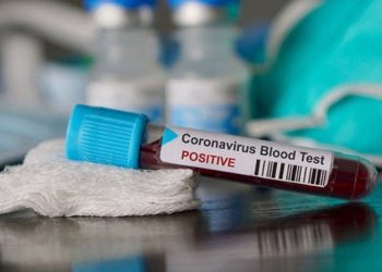 Kabupaten Bolmong Ketambahan Satu Kasus Positif