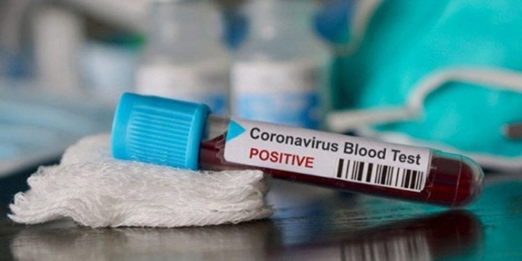 Kabupaten Bolmong Ketambahan Satu Kasus Positif