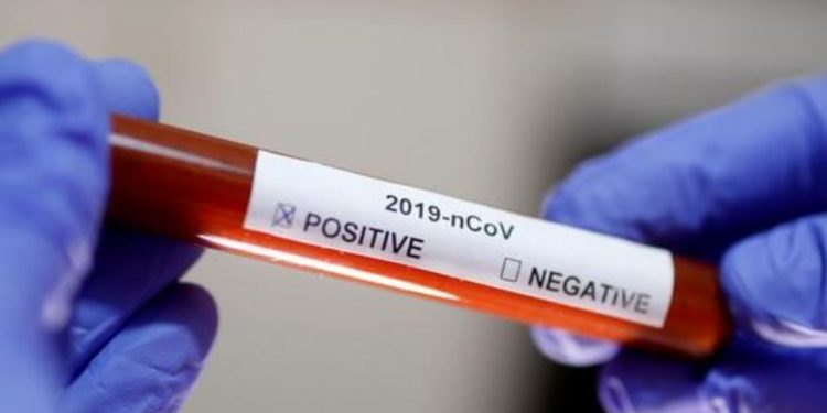 Satu Warga Mopait Bolmong Positif Corona