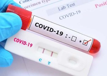 Inilah Tiga Pasien Asal Bolmong Yang Dinyatakan Positif Covid-19